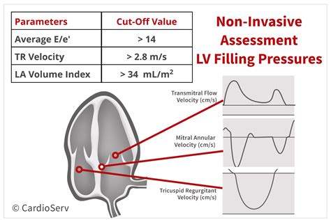 Lv filling pressure measurement